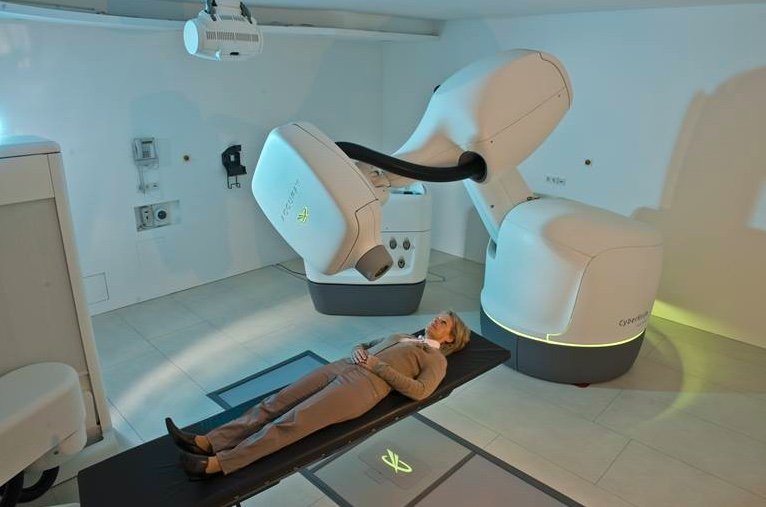 High-precision irradiation instead of a scalpel: KUKA robotics for modern treatment of tumors